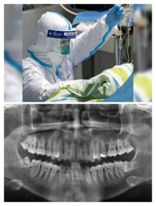 Cbct scans in the times of Corona